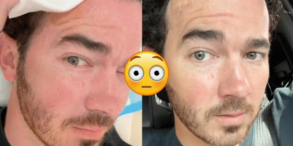 Kevin Jonas se somete a cirugía para eliminar cáncer de piel