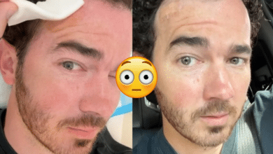 Kevin Jonas se somete a cirugía para eliminar cáncer de piel