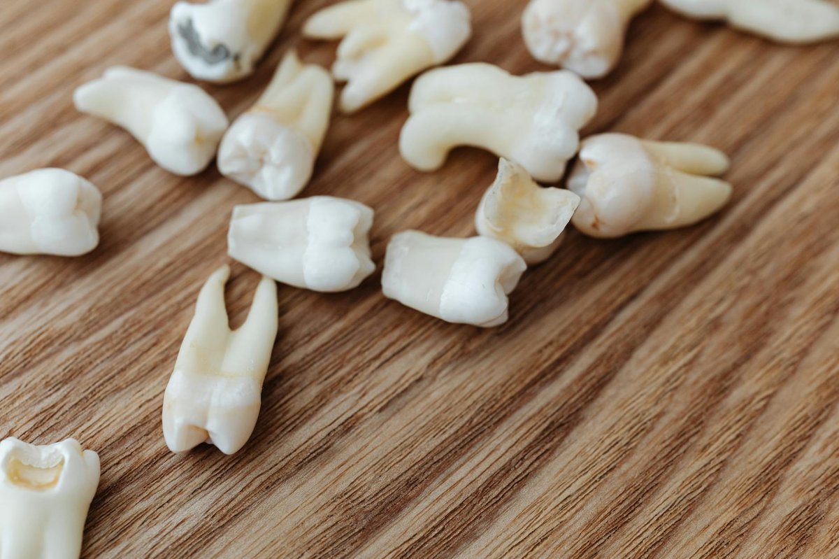 Cim del Molar