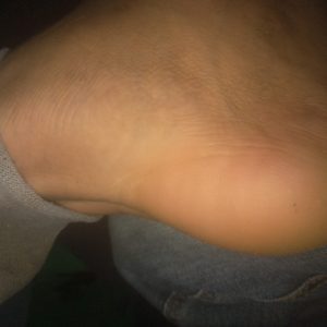 Pack do pé