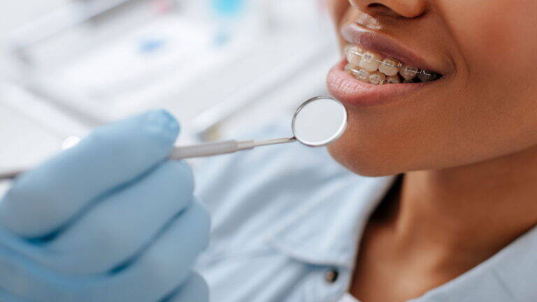 Do Sorriso Tímido ao Radiante: A Magia da Odontologia na Autoestima