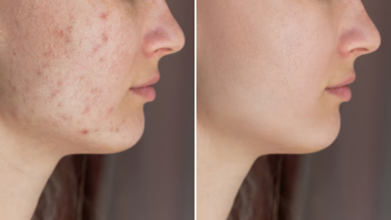 Cerave Gel de Limpeza – O Gel de Limpeza Facial com Ácido Salicílico que Está Conquistando a Internet!