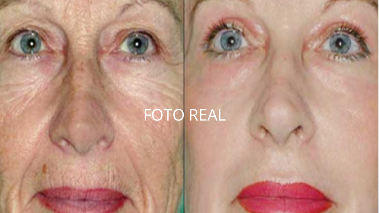 Instant Ageless: Transforme Sua Pele em 2 Minutos – Resultados Visíveis na Hora!