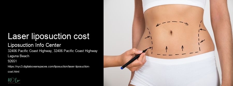 laser liposuction cost