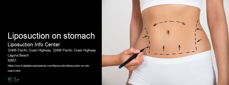 liposuction on stomach