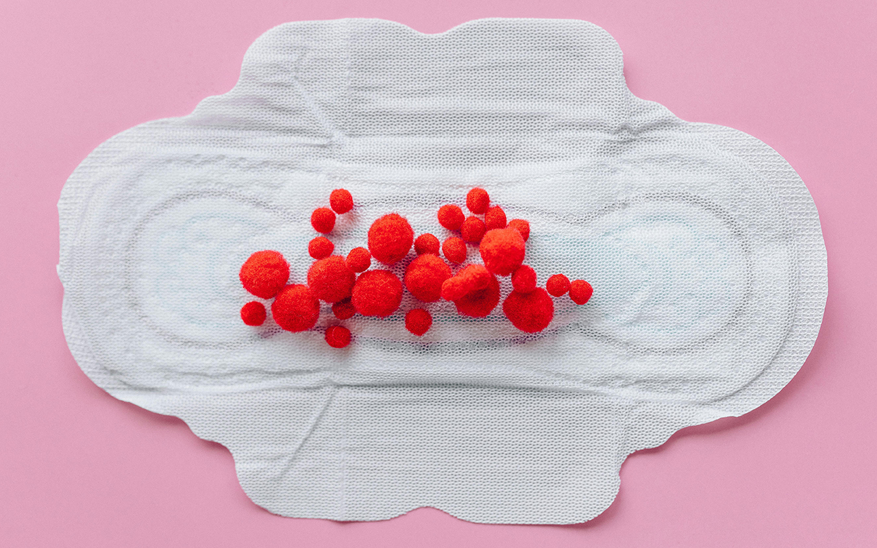 Open sanitary napkin topped with small red balls of fabric standing in for menstrual blood.
