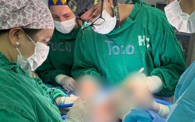 Recién nacida fue sometida a compleja cirugía de extirpación tumoral