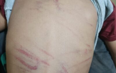 Detienen a mujer que habría agredido a su hijastro de 3 años