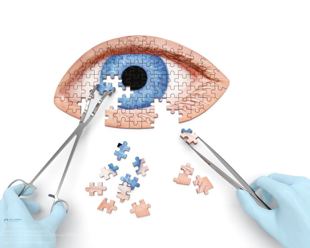 Lasik Eye Surgery Portland