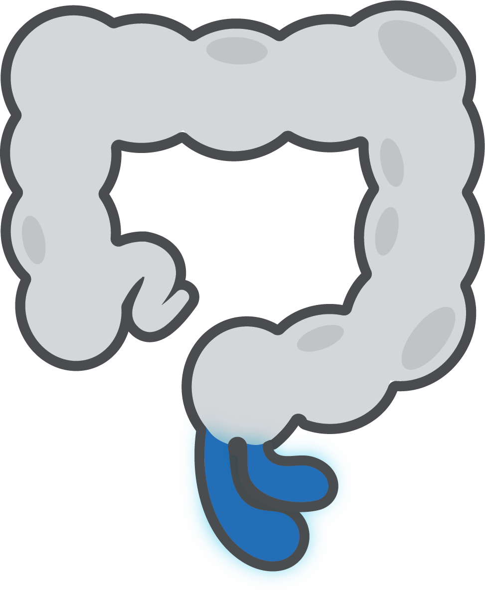Rectal Prolapse