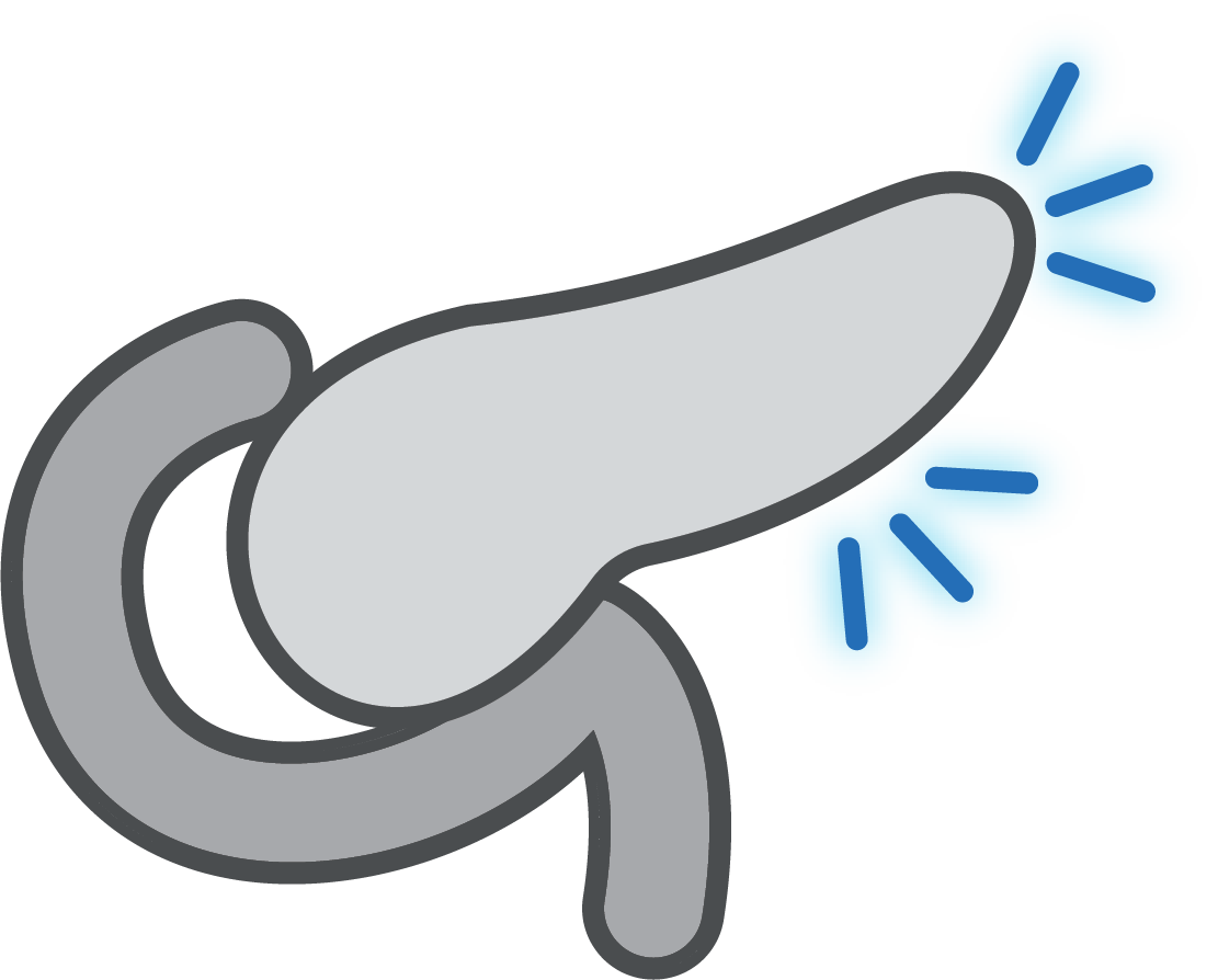 Pancreatitis