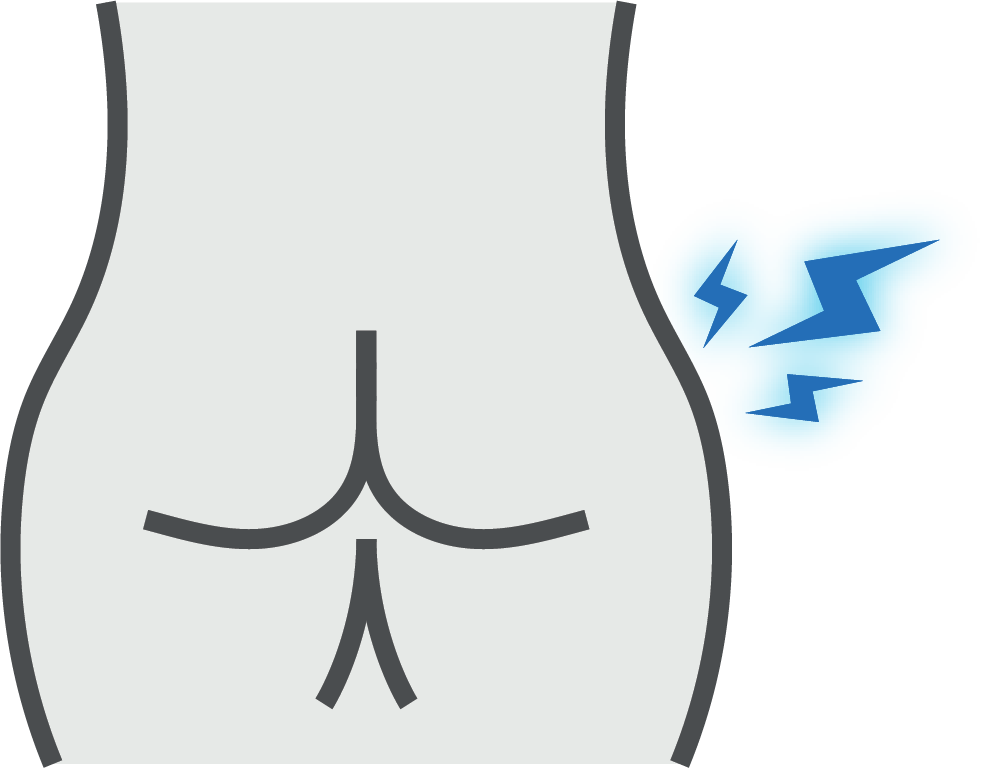 Anal Fissures