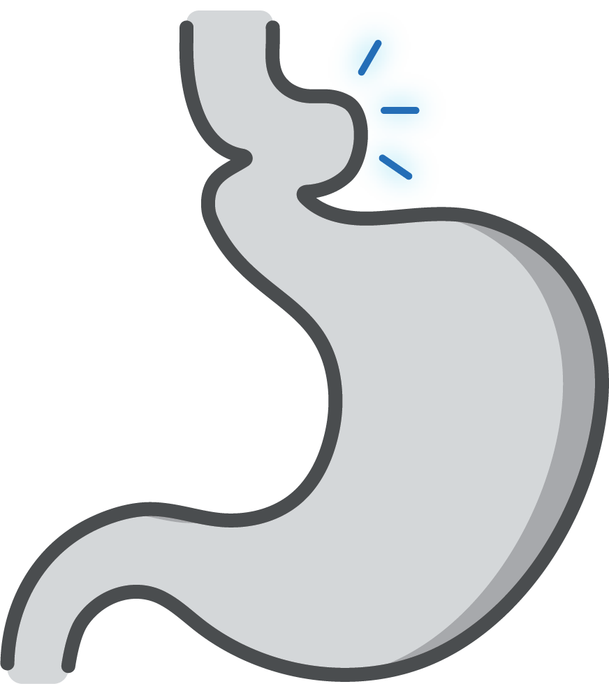 Hiatal Hernia