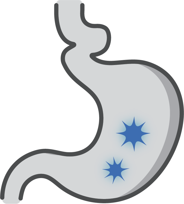 Peptic Ulcers