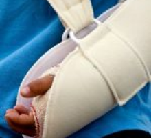 a child with broken left arm in a sling healing after a bone fracture