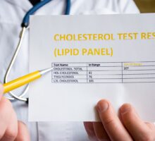 Doctor shows cholesterol test results but no Lp(a) data