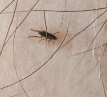 flea and tick bites transmit dangerous pathogens to humans