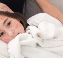 girl with red measles rash on face, lying on mother's lap, covered with blanket