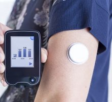continuous glucose monitor sensor in place on arm with handheld mobile phone readout
