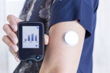 continuous glucose monitor sensor in place on arm with handheld mobile phone readout shows how patients are using technology