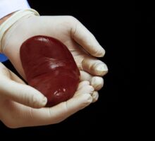 kidney for transplant