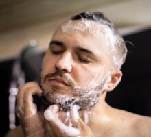 Man with seborrheic dermatitis-dandruff-on hair and face with shampoo