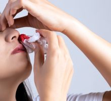 woman with a nosebleed