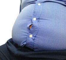 Obesity: Fat man wears tight blue shirt