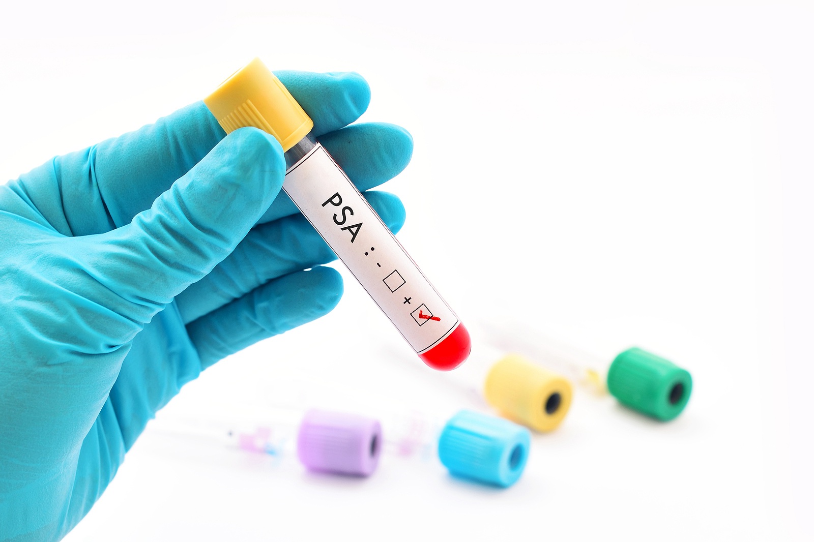 How Doctors Are Changing the Odds Against Breast & Prostate Cancer