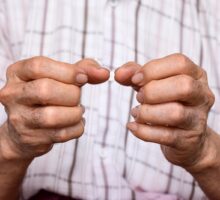 Man with painful arthritis hands