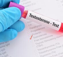 testosterone test