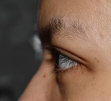 Thinning Eyebrows at the outer edge
