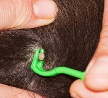 removing a tick from the scalp