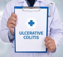 Doctor holds a clipboard with the words ulcerative colitis