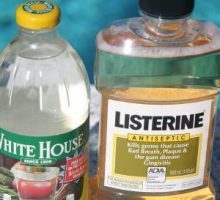 bottles of listerine and white vinegar help curing nail fungus