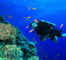 scuba diver uses mustard to ease leg cramps