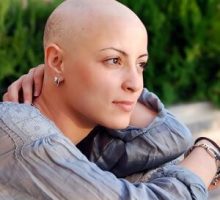 a female cancer patient with no hair