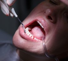 a dentist checking a patient for gum disease