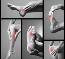 Photo illustration of various locations of leg and foot cramps, muscle cramp pain