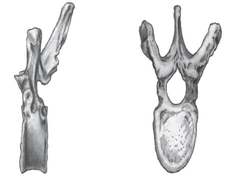 Label these bony landmarks on the following illustration: rib facet, spinous process, transverse...