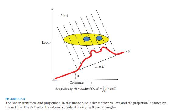 Find the Radon transform, using ? as shown in Figure 9.7-4, of the following image at ? = (a) 0°,...-2