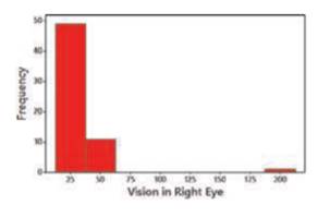 n Confidence level is 90%, s is not known, and the histogram of right-eye vision measurements is...