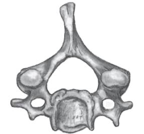 Label these bony landmarks on the following illustration: body, transverse foramen, spinous process....