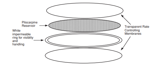 A schematic diagram of the OcusertR system for delivery of pilocarpine is shown in the accompanying...