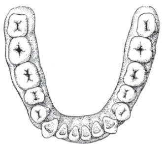 Label these teeth on the following illustration and color each of the four tooth types in a...