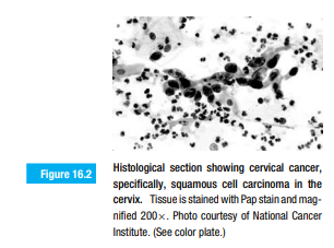 Biological dyes are used to prepare a Pap smear, such as the one shown in Figure 16.2. How do you...