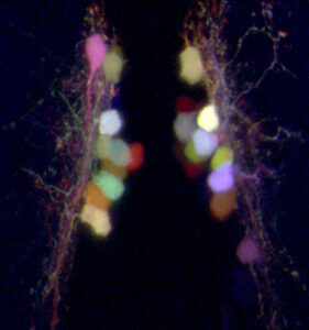 Individually labeled neurons in a 5-day-old zebrafish larva expressing the “Brainbow” transgene, which allows each hypothalamic wake-promoting neuron to be labeled with a different color. This technique allows Prober and his research group to trace each neuronal projection throughout the whole animal. (Image: David Prober)
