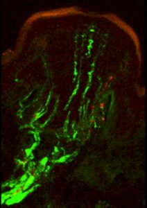 The sensitivity of the star-nosed mole’s tactile system is mediated by tens of thousands of specialized touch organs, called Eimer’s organs, which stud the rays of its star. Shown here is a confocal micrograph of a single Eimer’s organ, with a neural cytoskeletal protein stained green and substance P, a touch- and pain-associated neuropeptide, stained red. (Image: Kristin Gerhold and Diana Bautista, UC Berkeley)
