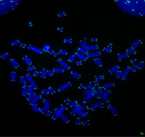 Rita Allen Foundation Scholar Titia de Lange studies how cells protect their chromosome ends, or telomeres, from damage by DNA repair mechanisms. This microscopic image shows human chromosomes labeled with a telomere-specific probe (green). (Image: Laboratory of Cell Biology and Genetics at The Rockefeller University/PLoS Genetics)