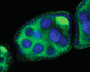 A developing fruit fly egg chamber, showing “nurse cells” that support the egg (blue) and a transposon (bright green), which will lead to sterility in the fly that develops from this egg. Rita Allen Foundation Scholar Gregory Hannon studies the Piwi-interacting RNA pathway, which protects the genomes of gamete-producing cells from disruptive transposons. (Image: Hannon Lab/CSHL)